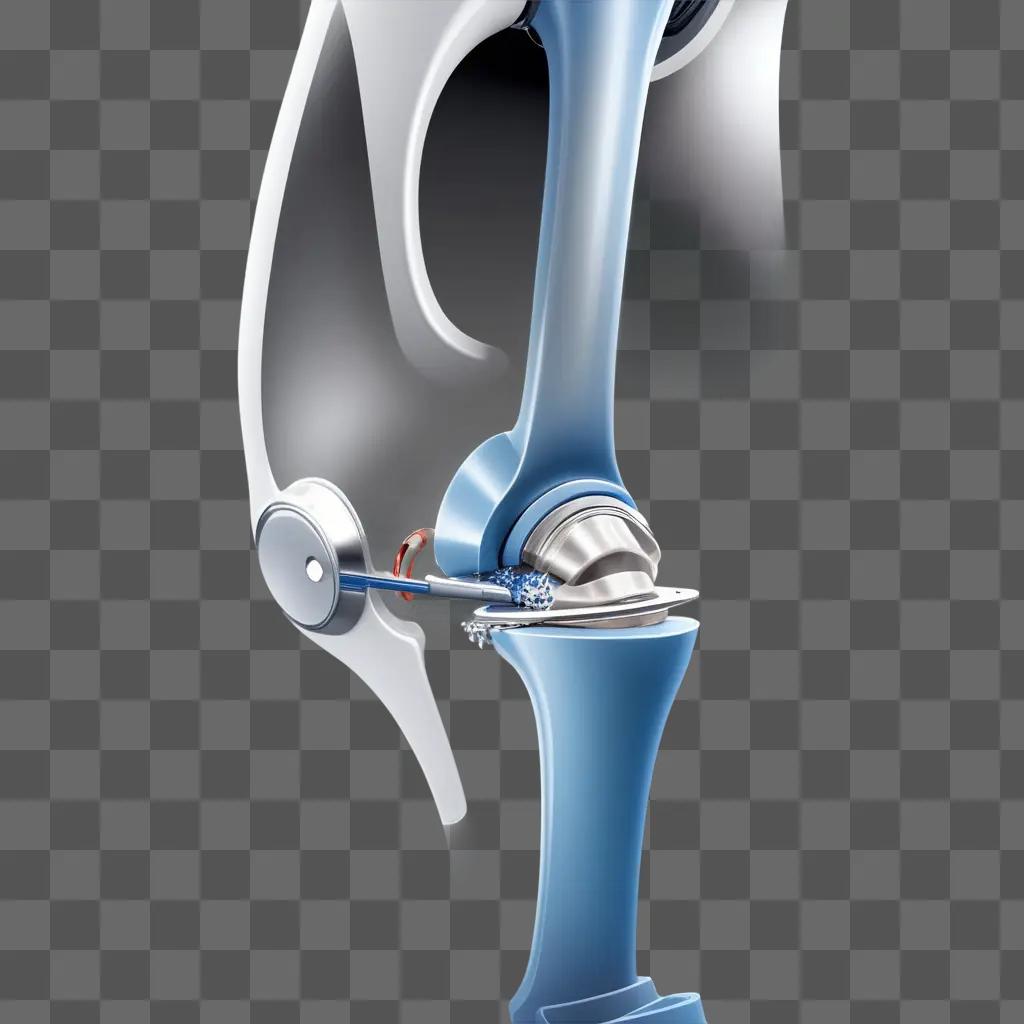 tificial knee replacement device in blue